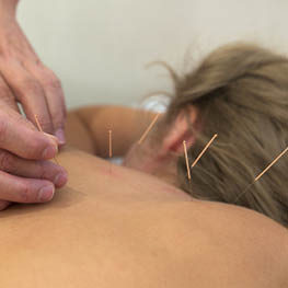 Akupunktur Basis Ausbildung